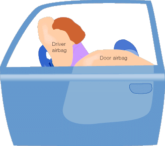 airbag3.gif